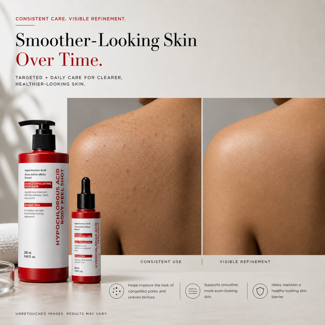 HypoPeel™ - Premium Hypochlorous Acid Peel Shot Duo