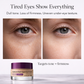 EyeLift™ - Premium Under-Eye Renewal Cream
