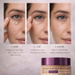 EyeLift™ - Premium Under-Eye Renewal Cream